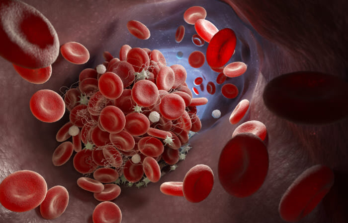Ampliação da cobertura obrigatória do exame anti-beta-2 glicoproteína I pelos planos de saúde